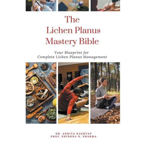 The Lichen Planus Mastery Bible: Your Blueprint for Complete Lichen Planus Management - Paperback